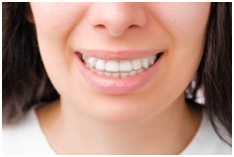 teeth straightening as an adult