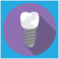 Pros of Dental Implants