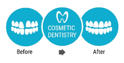 Cosmetic Dentistry