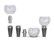 Dental implants