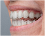 Invisalign