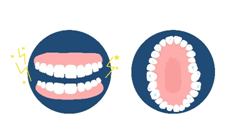 Mouth Guard