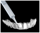 Teeth whitening procedure